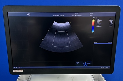 Color Doppler&nbsp;|&nbsp;GE&nbsp;|&nbsp;Vivid E95 Urtla Edition