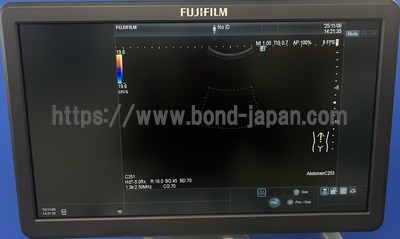 超音波診断装置/カラードプラ&nbsp;|&nbsp;富士フイルムヘルスケア&nbsp;|&nbsp;ARIETTA 65LELVの写真