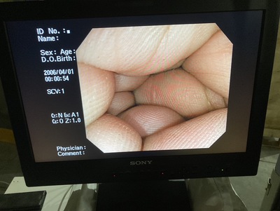 Endoscopy System&nbsp;|&nbsp;OLYMPUS&nbsp;|&nbsp;LUCERA CV-260SL