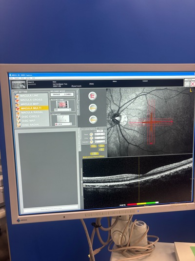 Retinal Camera and OCT Combined&nbsp;|&nbsp;NIDEK&nbsp;|&nbsp;RS-3000