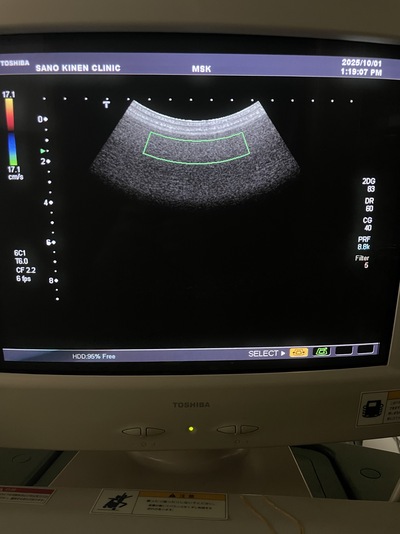 Ultrasound Color Doppler&nbsp;|&nbsp;CANON&nbsp;|&nbsp;SSA-700A Aplio50