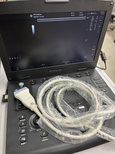 Portable Color doppler&nbsp;|&nbsp;GE&nbsp;|&nbsp;Versana Active