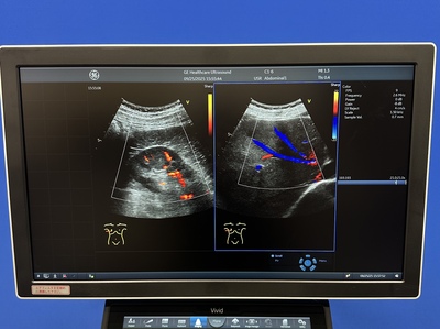 Ultrasound&nbsp;|&nbsp;GE&nbsp;|&nbsp;Vivid S60N