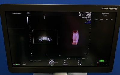 4D Ultrasound&nbsp;|&nbsp;GE&nbsp;|&nbsp;Voluson E10 BT21