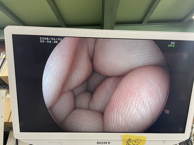 Endoscopy System&nbsp;|&nbsp;FUJIFILM&nbsp;|&nbsp;EPX-3000