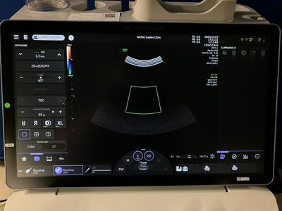 4D Ultrasound&nbsp;|&nbsp;GE&nbsp;|&nbsp;Voluson Swift BT23