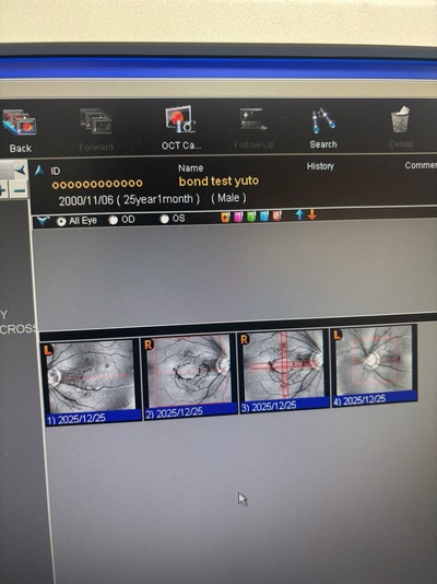 Optical Coherence Tomography ・OCT&nbsp;|&nbsp;NIDEK&nbsp;|&nbsp;RS-3000 Lite