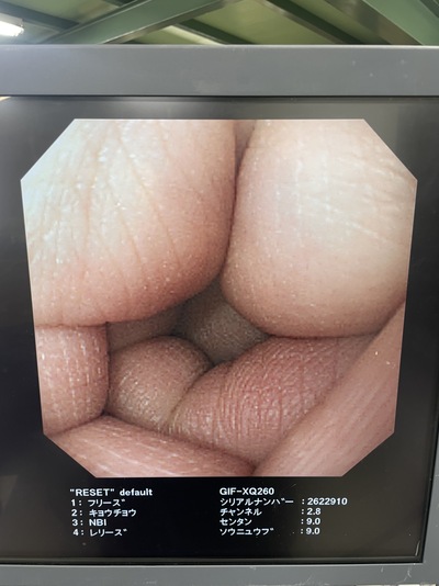 Endoscopy System&nbsp;|&nbsp;OLYMPUS&nbsp;|&nbsp;LUCERA CV-260SL