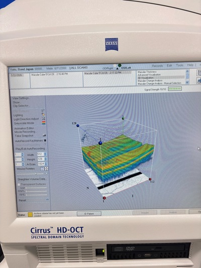 OCT&nbsp;|&nbsp;Carl Zeiss&nbsp;|&nbsp;Cirrus 4000 HD OCT