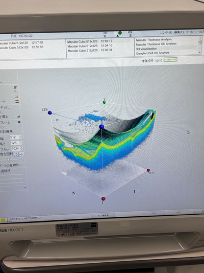 OCT&nbsp;|&nbsp;Carl Zeiss&nbsp;|&nbsp;Cirrus 500 HD-OCT Plus