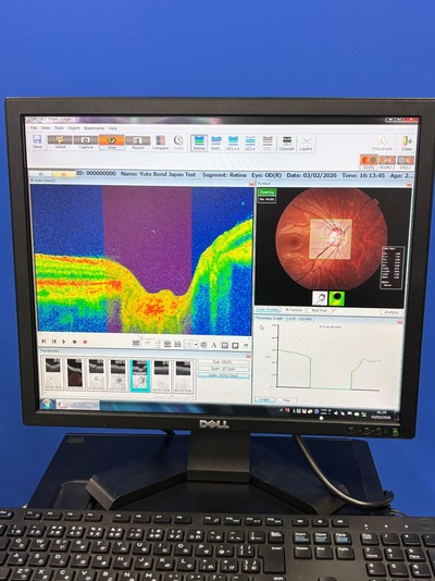 OCT With Angiography&nbsp;|&nbsp;TOPCON&nbsp;|&nbsp;DRI OCT Triton plus