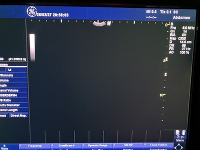 Color Doppler&nbsp;|&nbsp;GE&nbsp;|&nbsp;LOGIQ P5