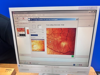 Retina Topo&nbsp;|&nbsp;Heidelberg Engineering GmbH&nbsp;|&nbsp;Retina Tomograph 2 HRT II