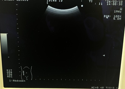 BW System&nbsp;|&nbsp;ALOKA&nbsp;|&nbsp;Prosound 6