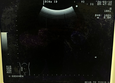 BW System&nbsp;|&nbsp;ALOKA&nbsp;|&nbsp;Prosound 6