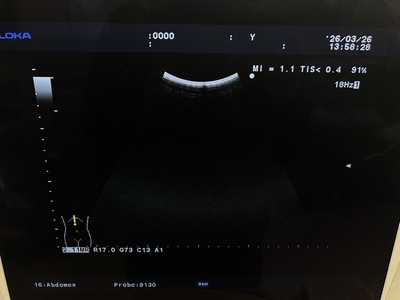 Ultrasound System&nbsp;|&nbsp;HITACHI&nbsp;|&nbsp;Prosound α7