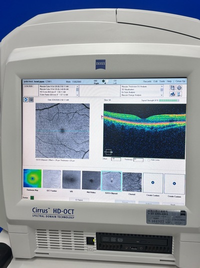 High-demended OCT&nbsp;|&nbsp;Carl Zeiss&nbsp;|&nbsp;Cirrus 4000 HD OCT