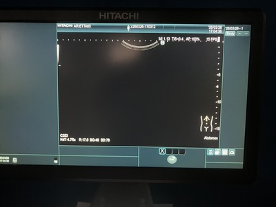 Ultrasound&nbsp;|&nbsp;HITACHI&nbsp;|&nbsp;Arietta 65