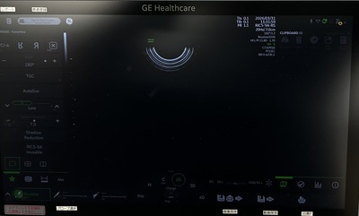 4D Ultrasound&nbsp;|&nbsp;GE&nbsp;|&nbsp;Voluson Swift BT23