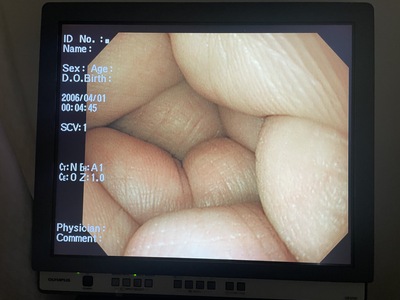 Endoscopy System&nbsp;|&nbsp;OLYMPUS&nbsp;|&nbsp;LUCERA CV-260SL