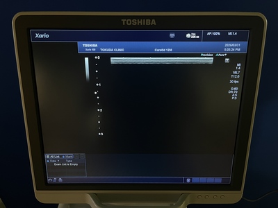 Color Doppler&nbsp;|&nbsp;CANON&nbsp;|&nbsp;TUS-X100 Xario 100