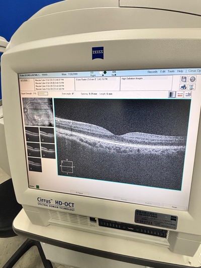 Windows 10 PRO Zeiss OCT&nbsp;|&nbsp;Carl Zeiss&nbsp;|&nbsp;Cirrus 4000 HD OCT