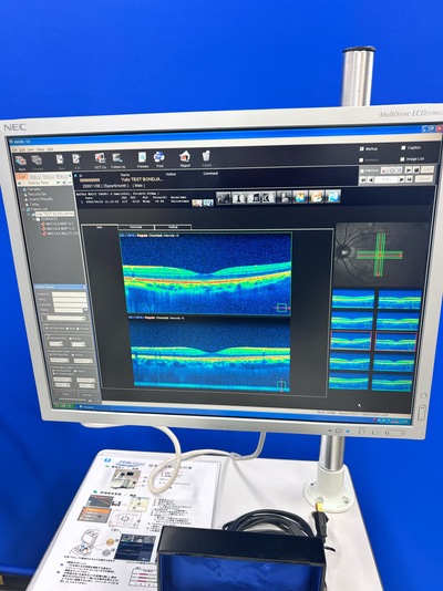Advanced OCT&nbsp;|&nbsp;NIDEK&nbsp;|&nbsp;RS-3000 Advance