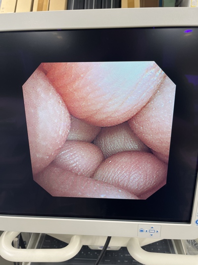 Laparoscope&nbsp;|&nbsp;OLYMPUS&nbsp;|&nbsp;LTF-240