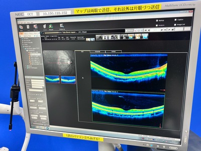 ANGIOGRAPHY installed OCT&nbsp;|&nbsp;NIDEK&nbsp;|&nbsp;RS-3000 Advance