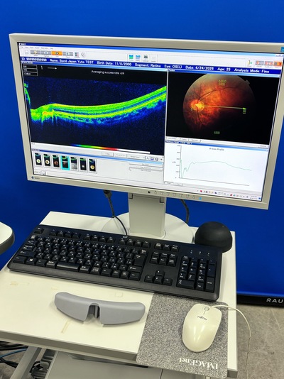 Windows 7 Pro OCT&nbsp;|&nbsp;TOPCON&nbsp;|&nbsp;3D OCT 2000 FA