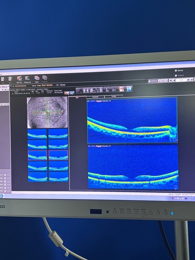 Advanced OCT + Fundus camera&nbsp;|&nbsp;NIDEK&nbsp;|&nbsp;RS-330 Retina Scan Duo
