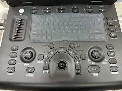 Portable Color doppler&nbsp;|&nbsp;GE&nbsp;|&nbsp;Versana Active