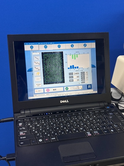 Specular Microscope&nbsp;|&nbsp;KONAN MEDICAL&nbsp;|&nbsp;NonconROBOⅡ- NSP-9900 Ⅱ