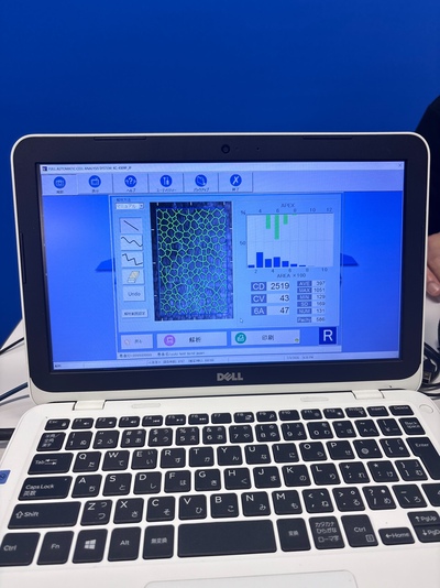 Specular Microscope&nbsp;|&nbsp;KONAN MEDICAL&nbsp;|&nbsp;NonconROBOⅡ- NSP-9900 Ⅱ