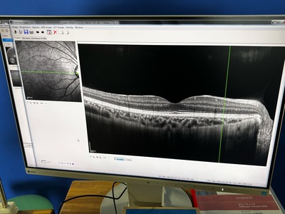 HRA2+ OCT+ WWE(55°), Retina and Glaucoma Module&nbsp;|&nbsp;Heidelberg Engineering GmbH&nbsp;|&nbsp;SPECTRALIS OCT2