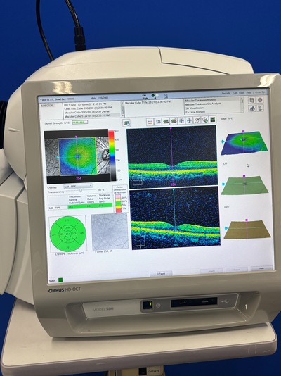 Making high-precision OCT more accessible. A feature-packed model that dramatically elevates the quality of daily clinical practice.&nbsp;|&nbsp;Carl Zeiss&nbsp;|&nbsp;Cirrus 500 HD-OCT Plus