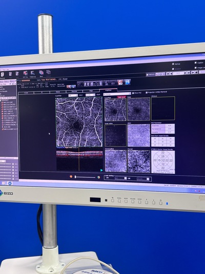 ANGIOGRAPHY Installed. No injections required. An unprecedented, high-definition 3D map of retinal blood flow drawn with light.&nbsp;|&nbsp;NIDEK&nbsp;|&nbsp;RS-3000 Advance