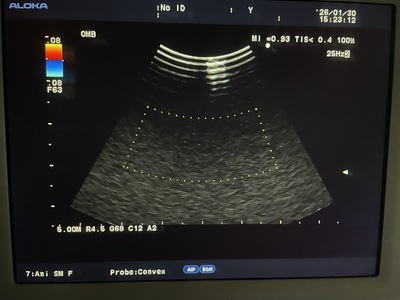 Ultrasound System&nbsp;|&nbsp;HITACHI&nbsp;|&nbsp;Prosound α7