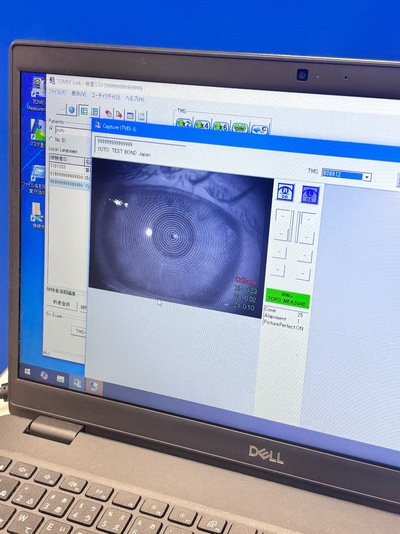 Placido Topography Meets 3-D Scheimpflug Imaging—A Hybrid Anterior Segment Analyzer Capturing the Full Corneal Profile in 0.5 Seconds.&nbsp;|&nbsp;TOMEY&nbsp;|&nbsp;TMS-5