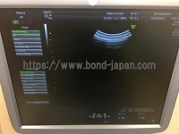 4D Ultrasound&nbsp;|&nbsp;GE&nbsp;|&nbsp;Voluson E8 Expert
