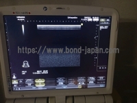 超音波診断装置&nbsp;|&nbsp;日立製作所&nbsp;|&nbsp;Noblusの写真