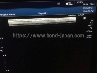 超音波診断装置/カラードプラ&nbsp;|&nbsp;キャノンメディカル株式会社&nbsp;|&nbsp;Aplio 400の写真