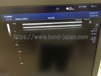 超音波診断装置/カラードプラ&nbsp;|&nbsp;キャノンメディカル株式会社&nbsp;|&nbsp;TUS-X100 Xario 100の写真