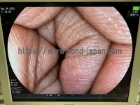 Video Gastroscope&nbsp;|&nbsp;FUJIFILM&nbsp;|&nbsp;EG-550WR