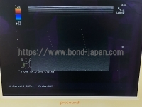 Color Doppler&nbsp;|&nbsp;ALOKA&nbsp;|&nbsp;Prosound Alpha 10