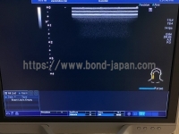 Color Doppler&nbsp;|&nbsp;CANON&nbsp;|&nbsp;TUS-X100 Xario 100