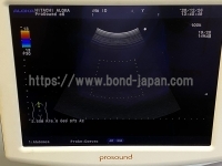 Color Doppler&nbsp;|&nbsp;HITACHI&nbsp;|&nbsp;Prosound α6