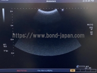 Color Doppler&nbsp;|&nbsp;CANON&nbsp;|&nbsp;SSA-790A Aplio XG