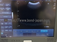 Color Doppler&nbsp;|&nbsp;CANON&nbsp;|&nbsp;Viamo SSA-640A