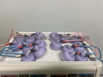 低周波・干渉波組合せ治療器　セダンテ　クレア&nbsp;|&nbsp;株式会社日本メディックス&nbsp;|&nbsp;SD-5602の写真